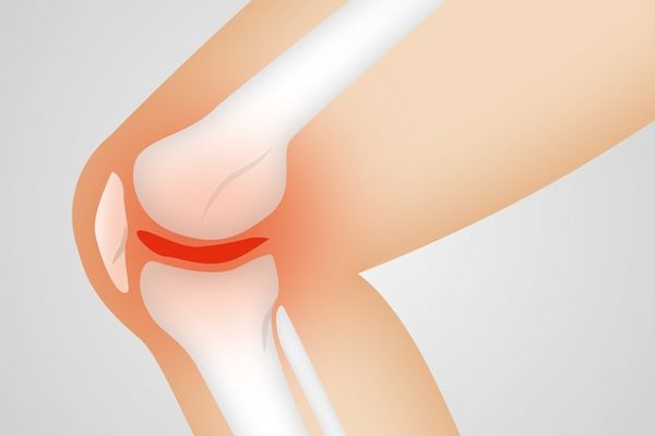 Lutter contre l’arthrose : les traitements et conseils a suivre